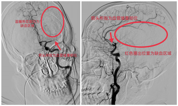 圖片 12 術(shù)前.jpg